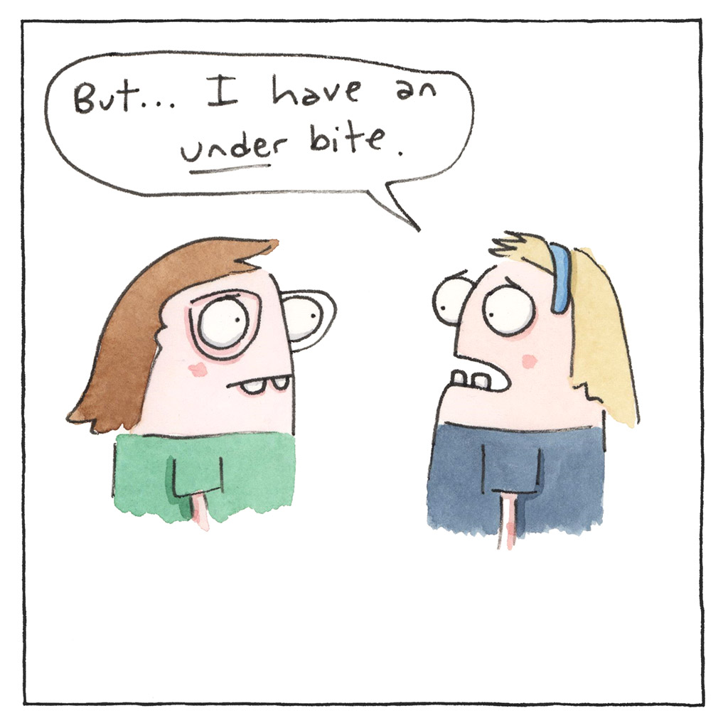 162-C-Underbite