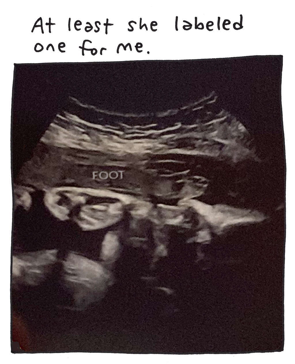962-H-Ultrasound